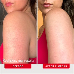 First Aid Beauty KP Bump Eraser Scrub ingredients list