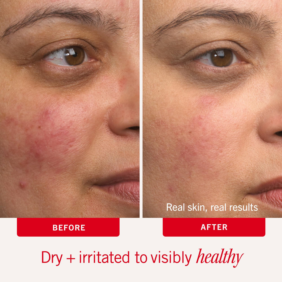 First Aid Beauty Ultra Repair Cream 12 oz packaging