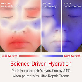 First Aid Beauty Ultra Repair Hydrating Pillow Pads opened with pads visible