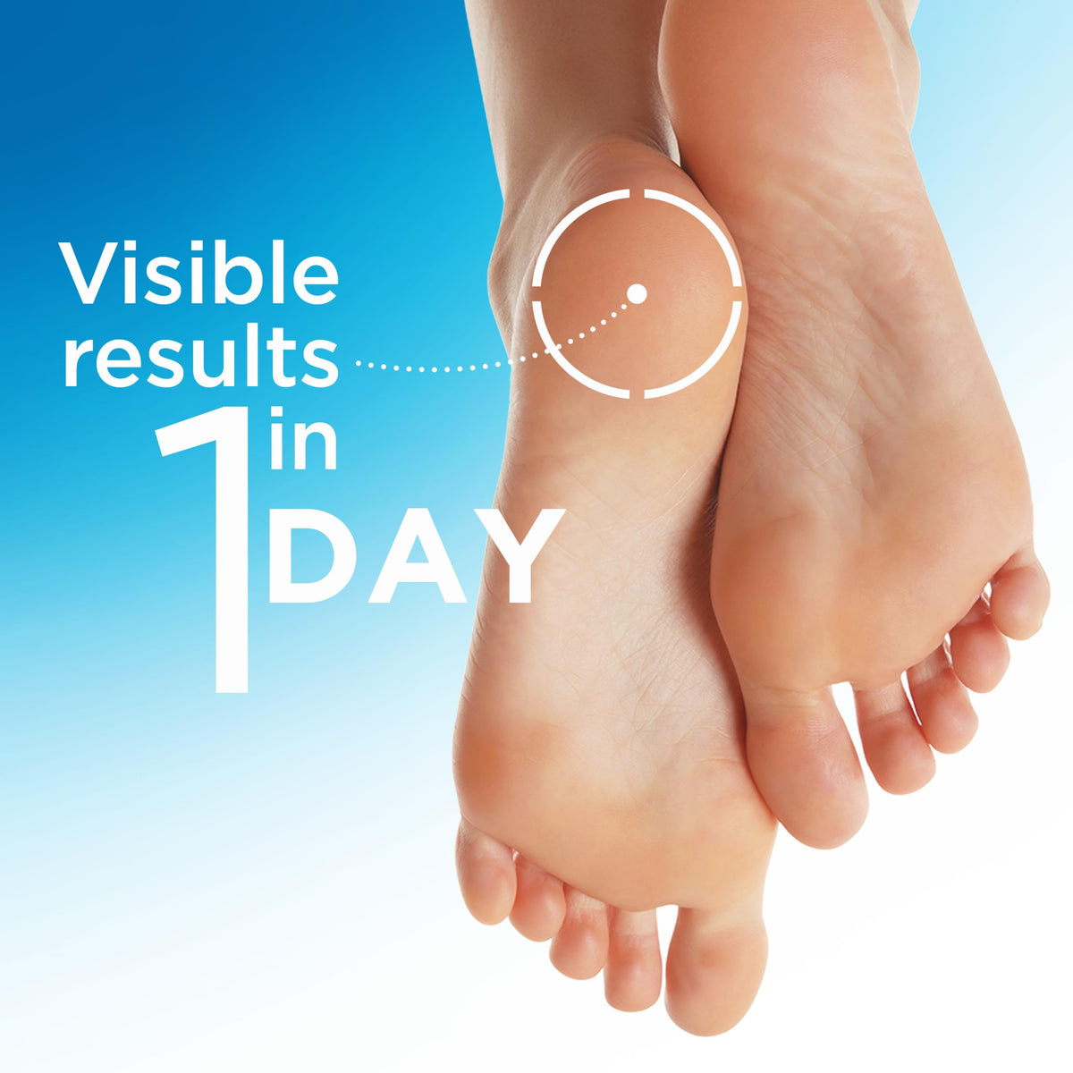 Flexitol Heel Balm application on dry cracked heels