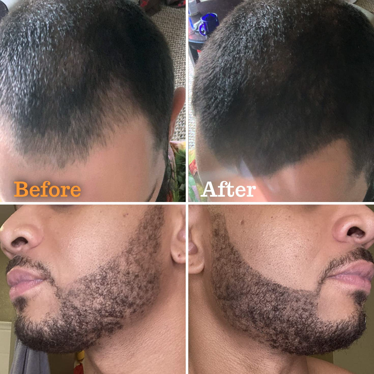 FOLLICLE support Beard Pen Filler Medium Black packaging