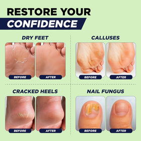 FOOT Tea Tree Oil Epsom Salt Foot Soak with feet soaking