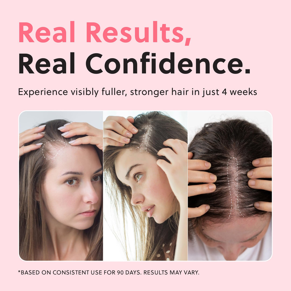 Forchics Hair Growth Spray ingredients close-up
