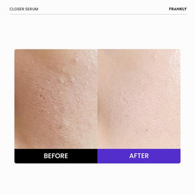 FRANKLY Closer Serum bottle with pump