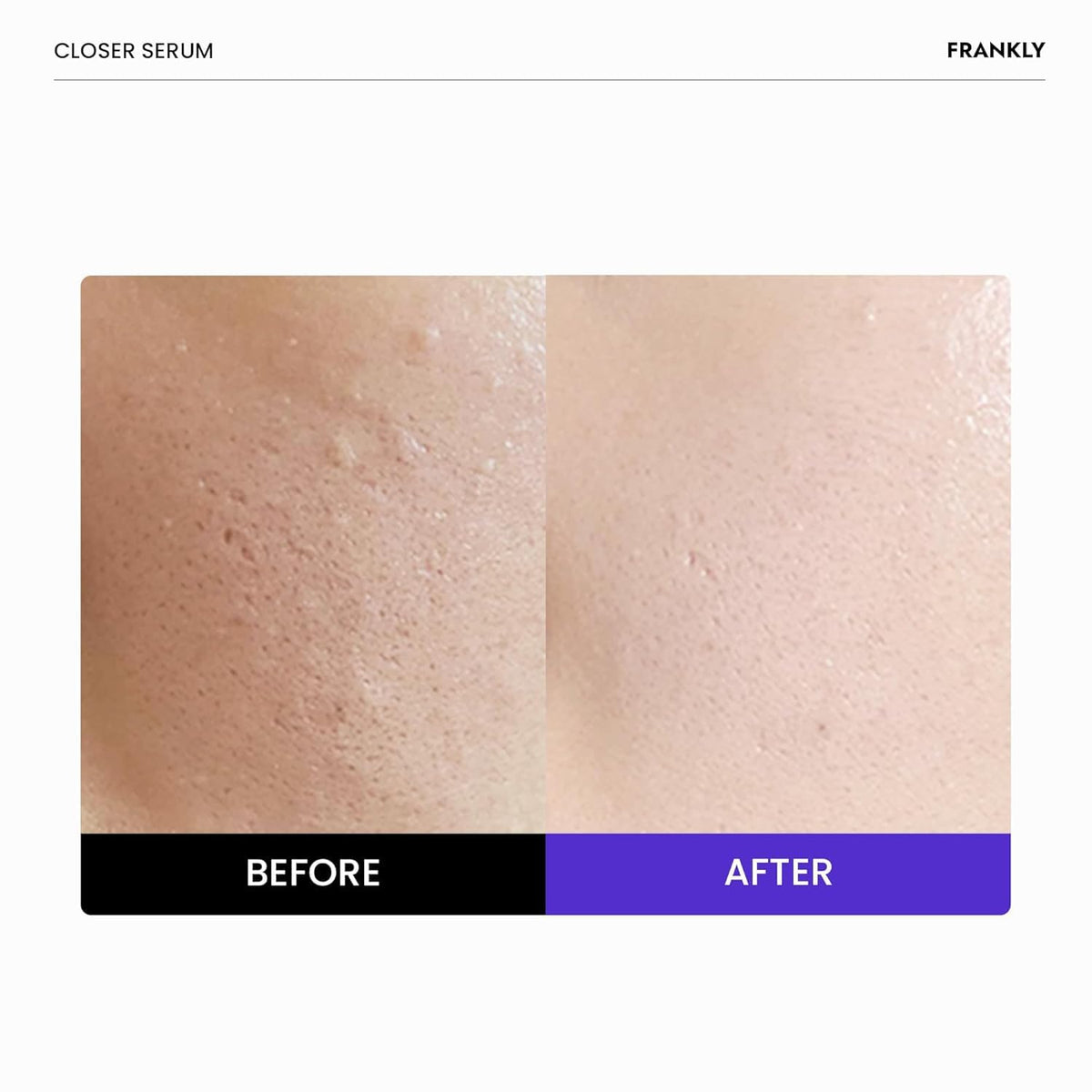 FRANKLY Closer Serum Mega Jumbo 3.38 fl oz back view