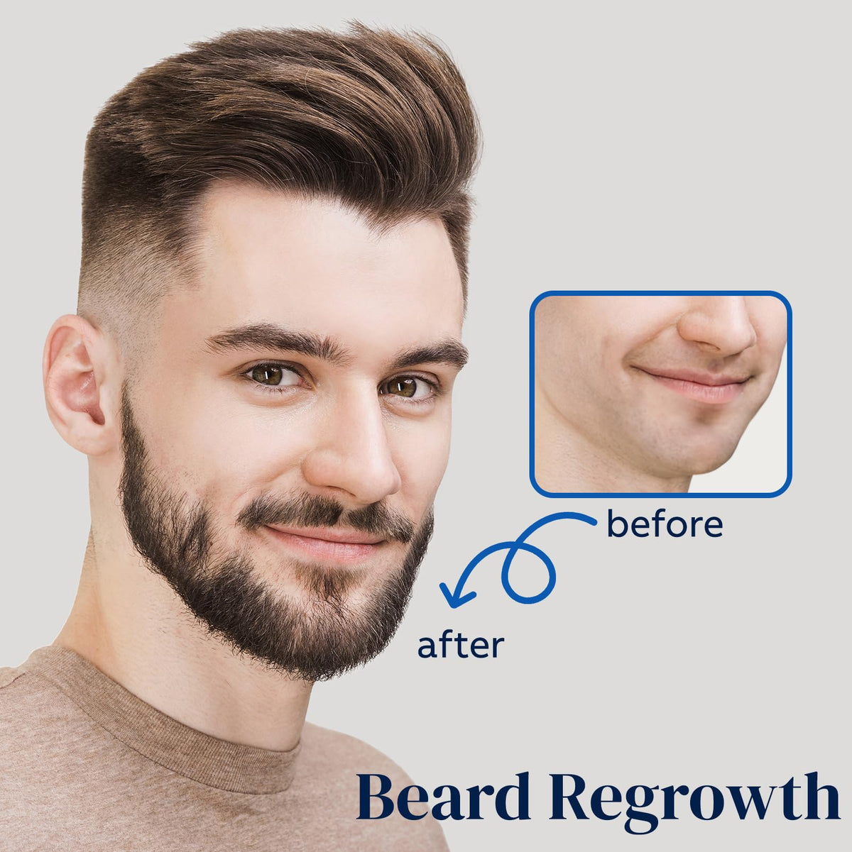 FUZYAT 5% Minoxidil Hair Growth Spray ingredients list