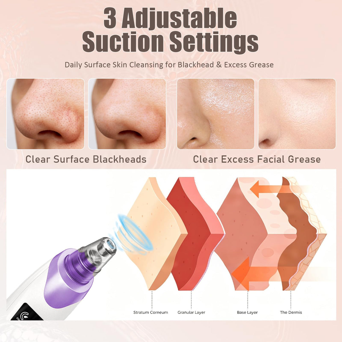 Gackoko Blackhead Remover Pore Vacuum with interchangeable probes