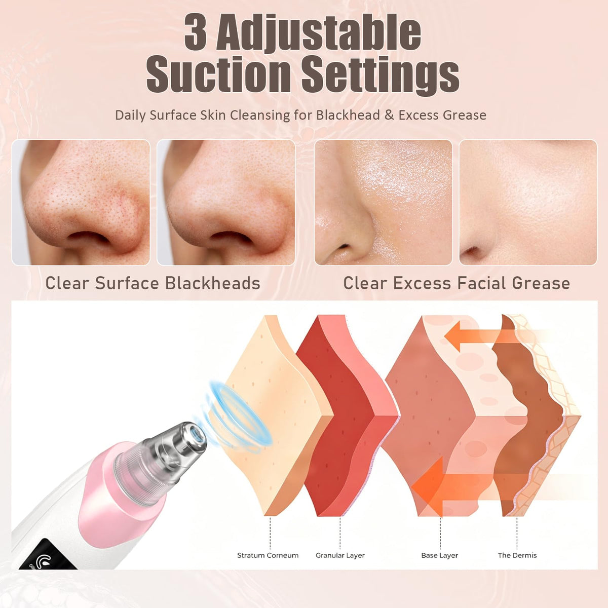 Gackoko Blackhead Remover Pore Vacuum with interchangeable probes