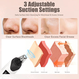 Gackoko Blackhead Remover screen showing suction mode
