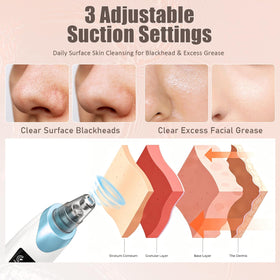 Gackoko Blackhead Remover with interchangeable probes