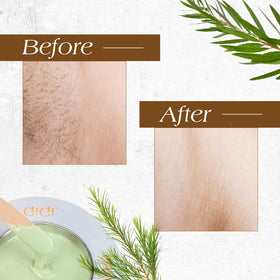 GiGi Tea Tree Crème Wax applied on skin during waxing