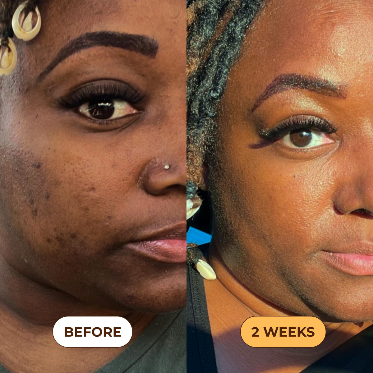 Glo Melanin Turmeric Scrub applied on skin