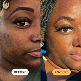 Glo Melanin Turmeric Scrub applied on skin