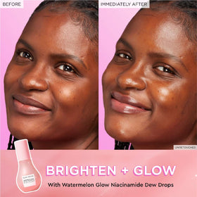 Glow Recipe Watermelon Niacinamide Dew Drops application on skin