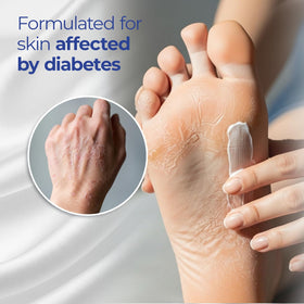 Goicoechea Diabet TX Diabetic Lotion 13.5 Oz side view