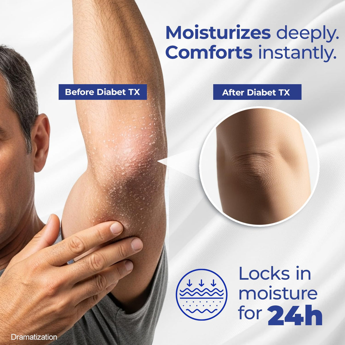 Goicoechea Diabet TX Diabetic Lotion 3 pack display