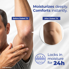 Goicoechea Diabet TX Diabetic Lotion 3 pack display