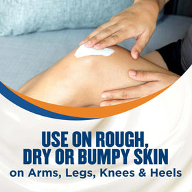 Gold Bond Rough & Bumpy Cream packaging details