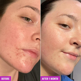 Good Molecules Clarify and Cleanse Bar packaging details