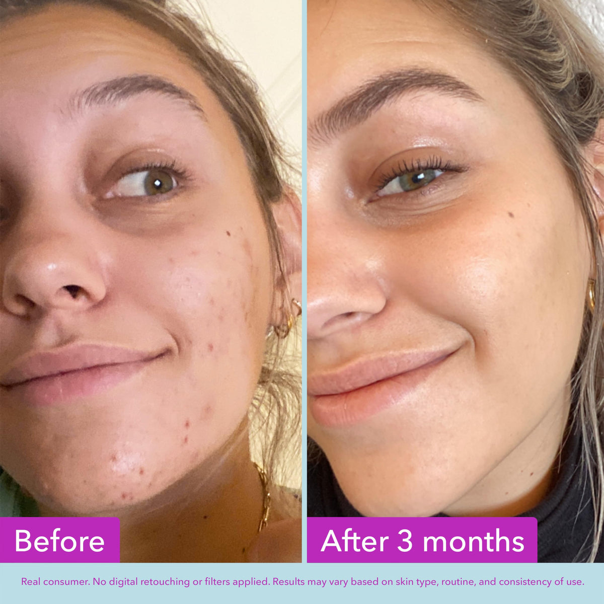 Good Molecules Niacinamide Brightening Toner application on cotton pad