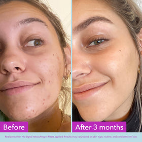 Good Molecules Niacinamide Brightening Toner ingredients list