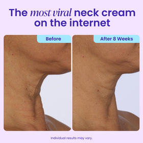 goPure Neck & Chest Moisturizer Cream 1.7oz application on skin