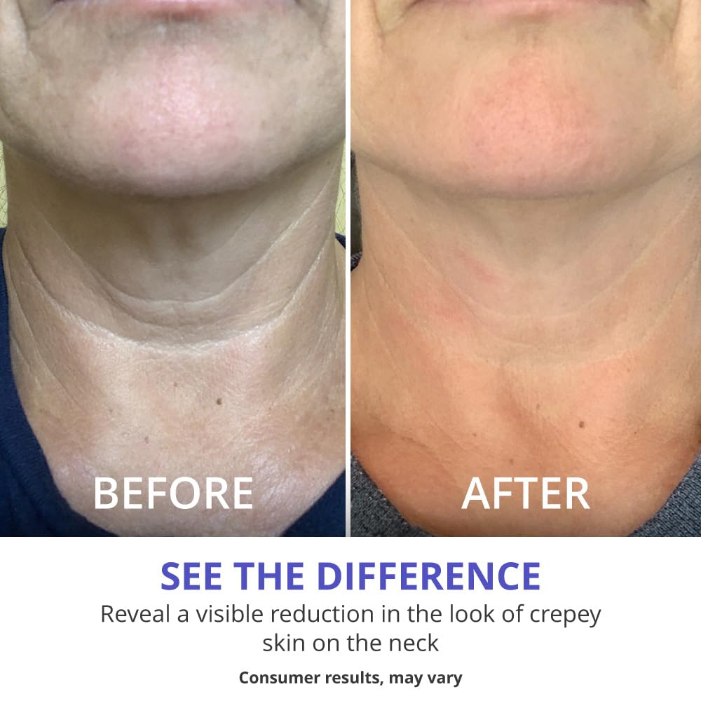 goPure Neck & Chest Moisturizer Cream lifestyle scene