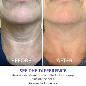 goPure Neck & Chest Moisturizer Cream lifestyle scene