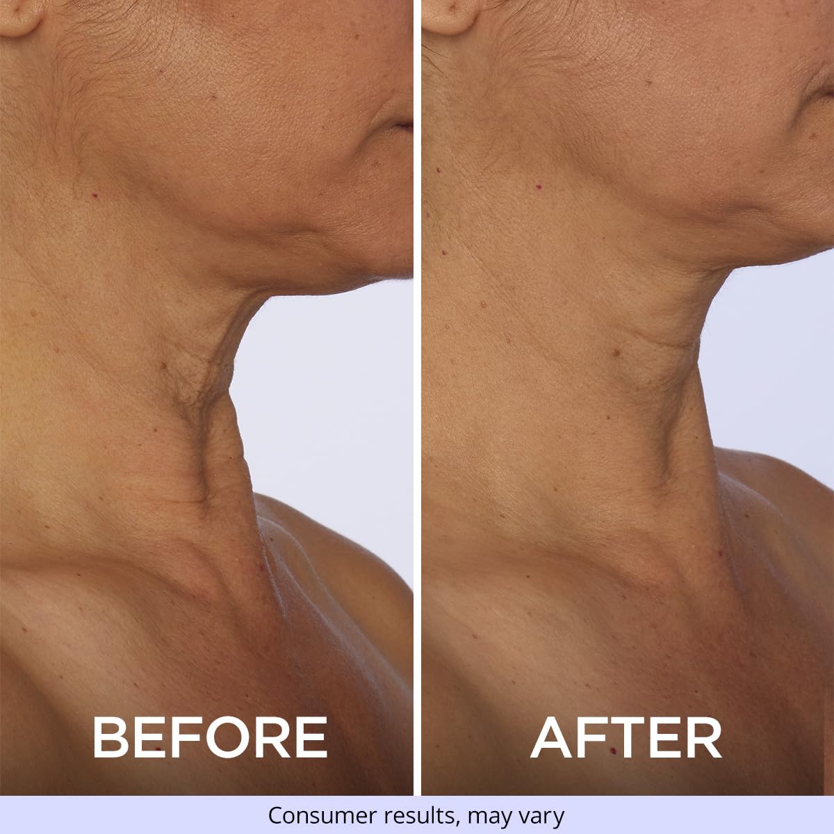 goPure Neck & Chest Moisturizer Cream open jar view