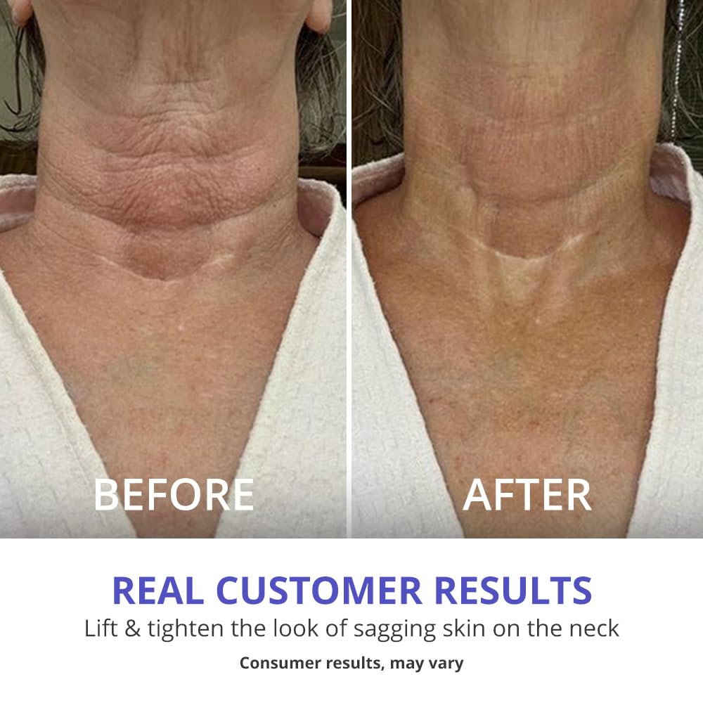 goPure Neck & Chest Moisturizer Cream with ingredients displayed