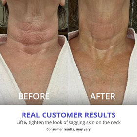 goPure Neck & Chest Moisturizer Cream with ingredients displayed