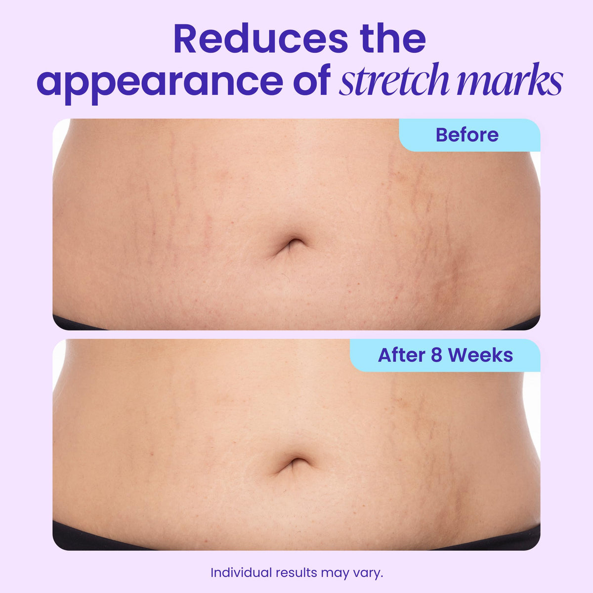 goPure Tighten & Smooth Belly Cream application on skin