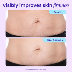 goPure Tighten & Smooth Belly Cream texture close-up