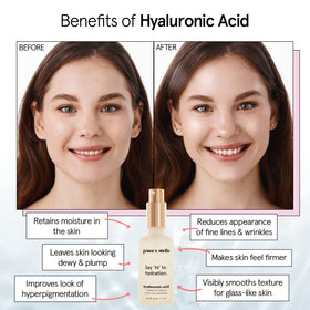grace & stella Hyaluronic Acid Serum 50ml with dropper