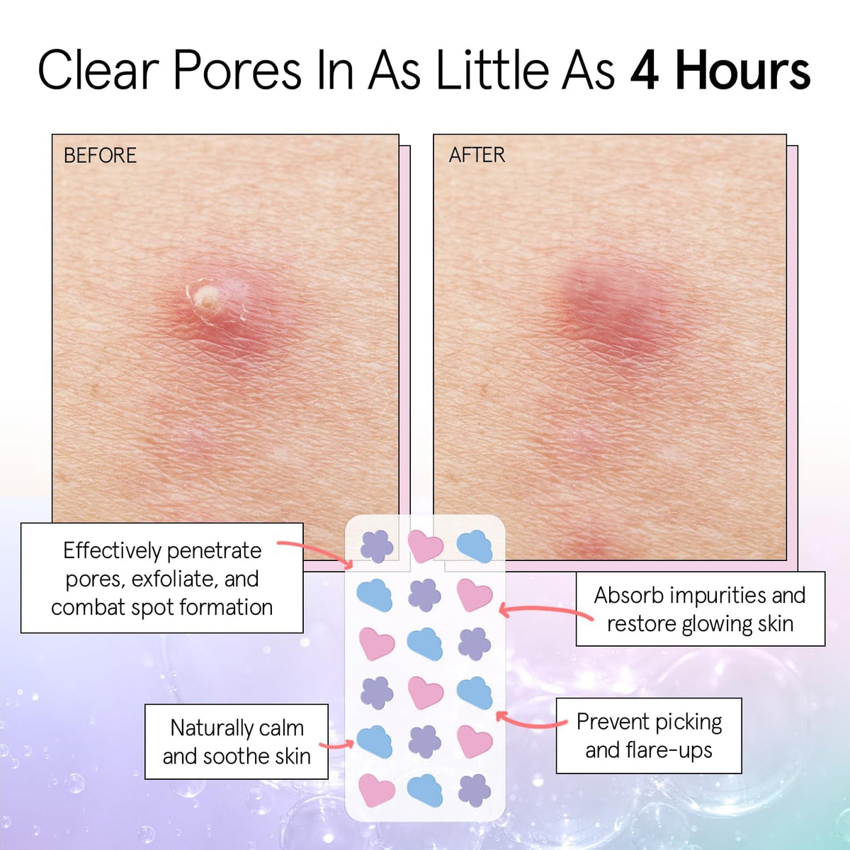 grace & stella hydrocolloid patches in use on skin