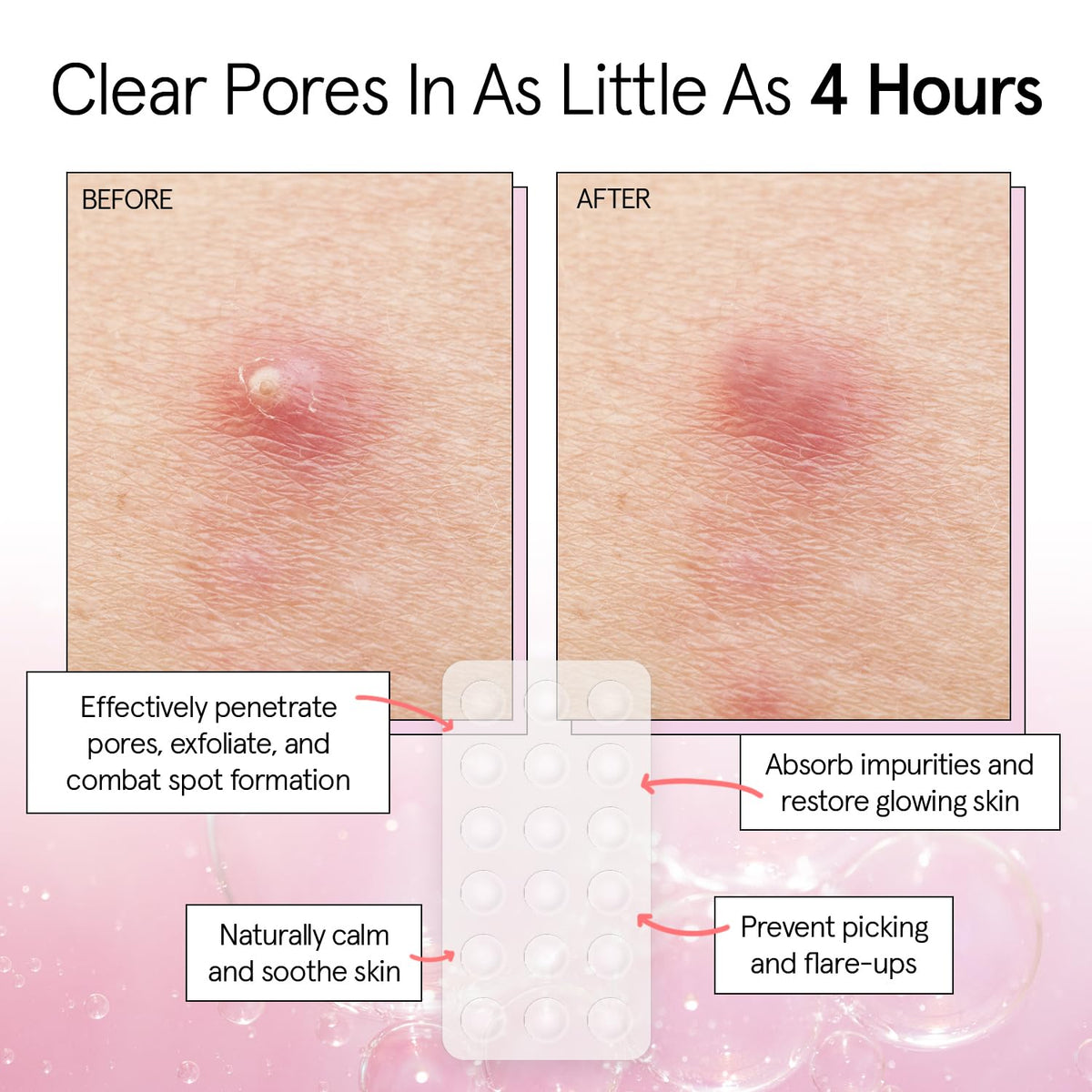 grace & stella Multi-Size Pimple Patches 10mm size close-up