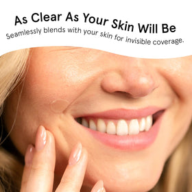grace & stella Multi-Size Pimple Patches ingredients list