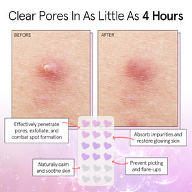 grace & stella Pore Strip Pimple Patches packaging side view