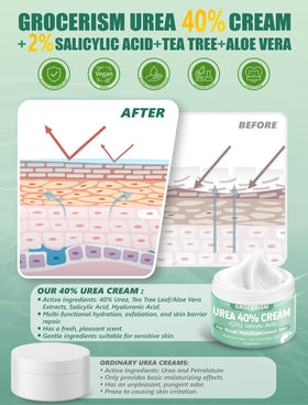 Grocerism Urea Cream 40% application on feet