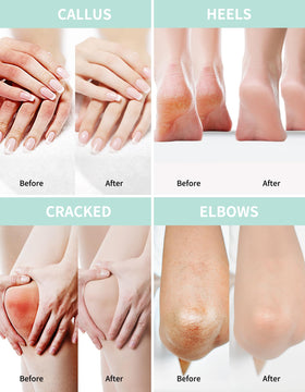 Grocerism Urea Cream 40% with aloe vera and tea tree