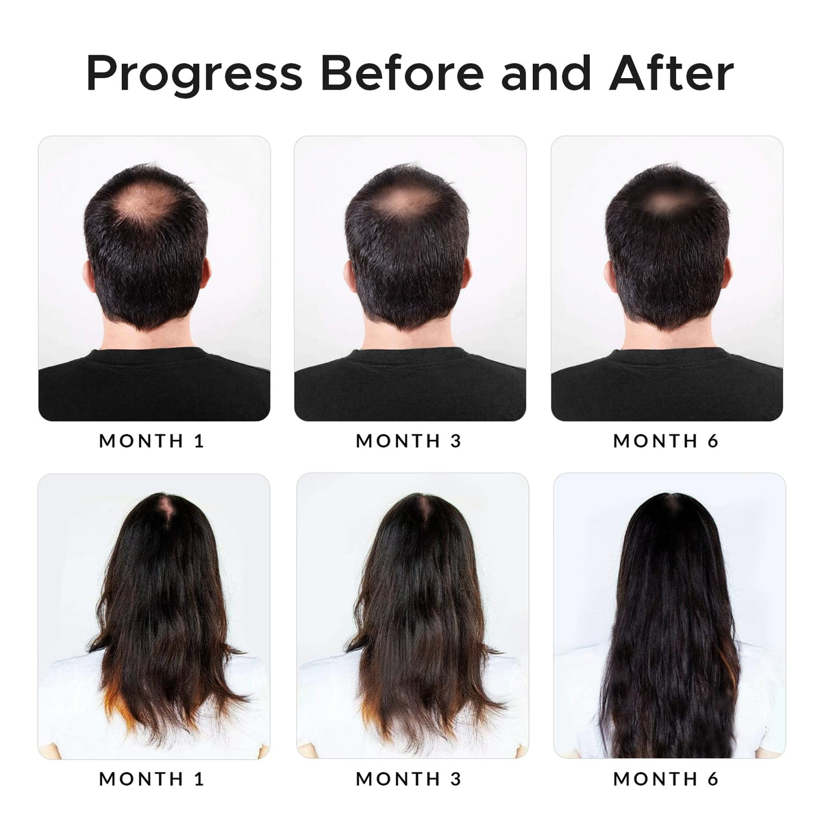 Growth Essence Minoxidil & Biotin Shampoo in a bathroom setting