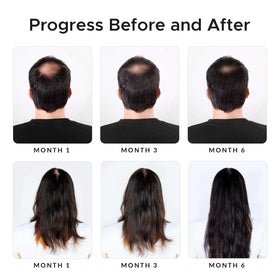 Growth Essence Minoxidil & Biotin Shampoo in a bathroom setting