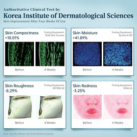GYH LED Face Mask in use, highlighting skin revitalization