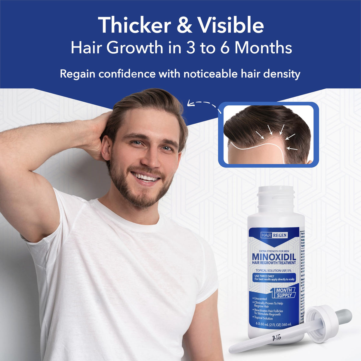 Hair Regen Minoxidil application on scalp