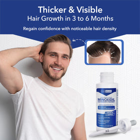 Hair Regen Minoxidil application on scalp