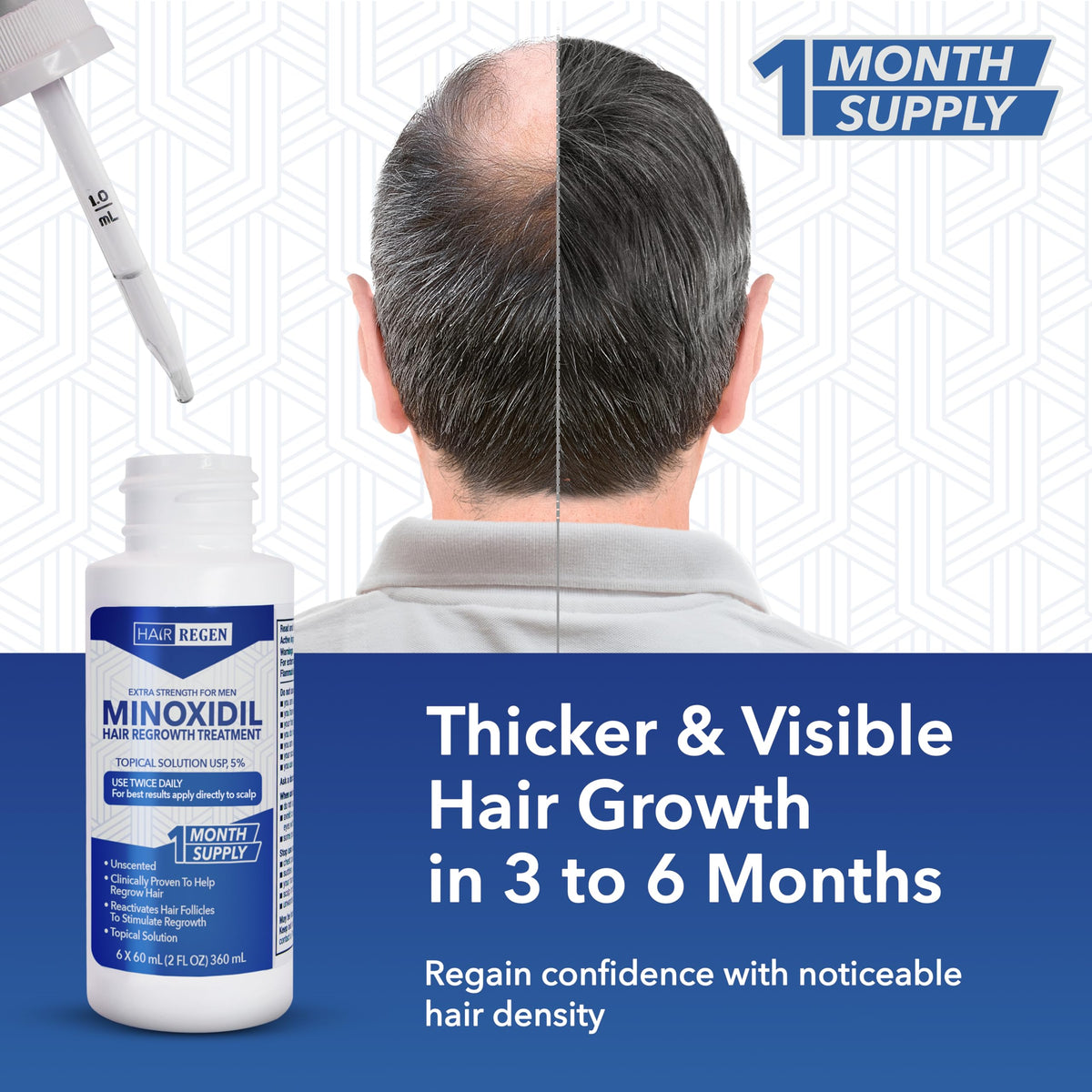 Hair Regen Minoxidil bottle showing 5% strength label