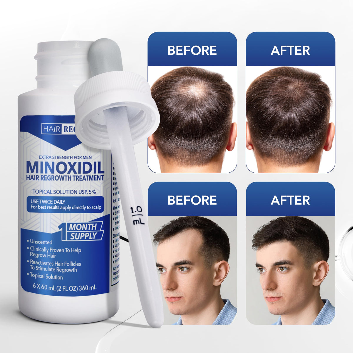 Hair Regen Minoxidil serum bottles on a shelf
