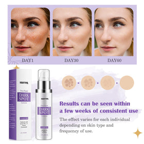 HANYWIL Dark Spot Remover Serum ingredients list