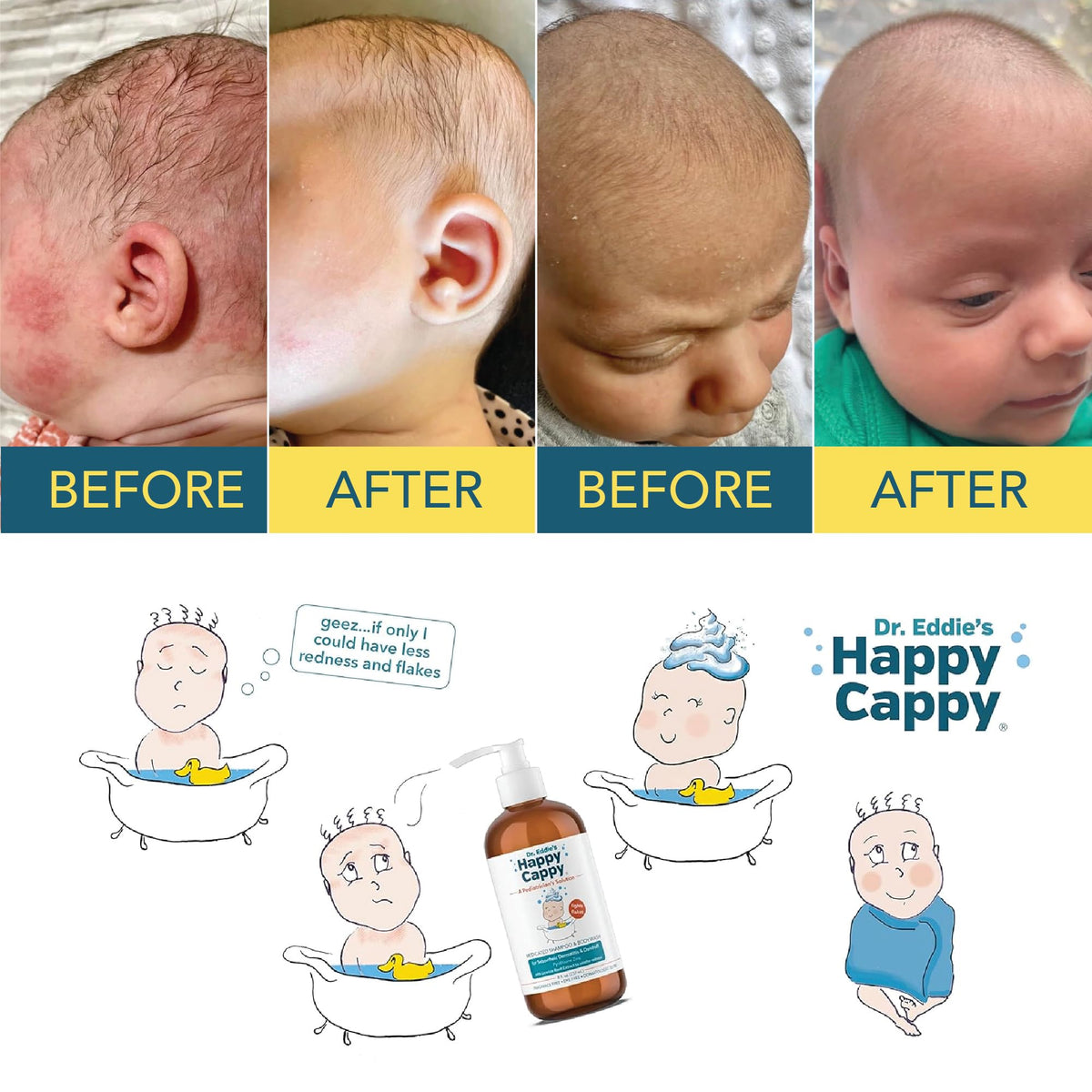 Happy Cappy Medicated Shampoo and Body Wash packaging details