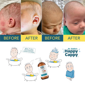 Happy Cappy Medicated Shampoo and Body Wash packaging details